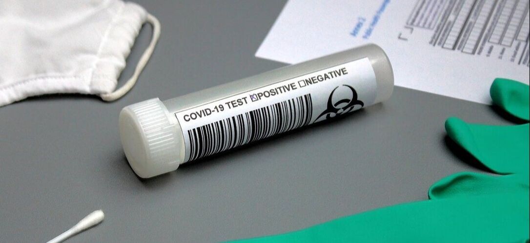 Coronavirus test